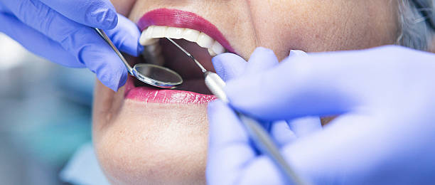Best Emergency Gum Treatment in Perkins, OK
